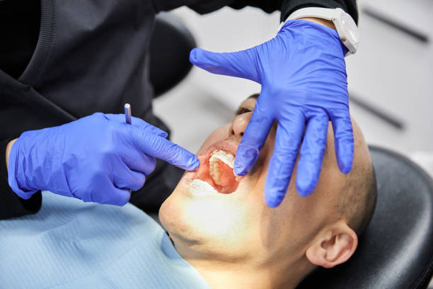 Best Broken or Chipped Tooth Repair in Lake Grove, NY